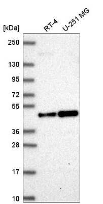 Western Blot: ORC4L Antibody [NBP2-56938]