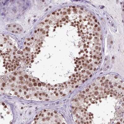 Immunohistochemistry-Paraffin: ORC5L Antibody [NBP1-82476]