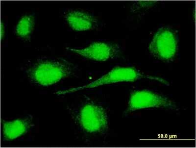 Immunocytochemistry/ Immunofluorescence: ORC6L Antibody (3C4) [H00023594-M04]