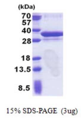 SDS-PAGE: Recombinant Human ORC6L His Protein [NBP2-23309]