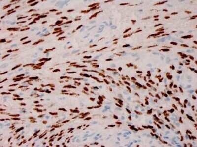 Immunohistochemistry-Paraffin: ORF73/HHV8 Antibody (HHV8/3606) [NBP3-07809]
