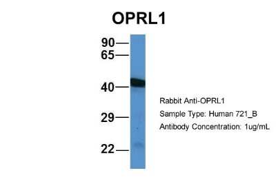 Western Blot: ORL1/OPRL1 Antibody [NBP1-69143]