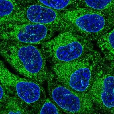 Immunocytochemistry/ Immunofluorescence: ORMDL1 Antibody [NBP2-56646]