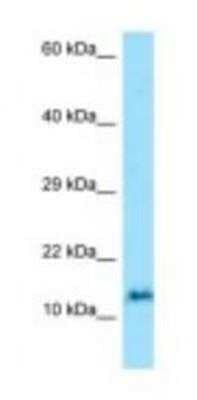 Western Blot: ORMDL3 Antibody [NBP1-98511]