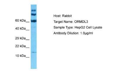 Western Blot: ORMDL3 Antibody [NBP1-98511]