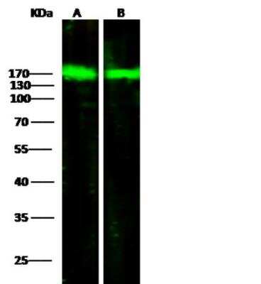 Western Blot: ORP150/HSP12A Antibody (201) [NBP2-89890]