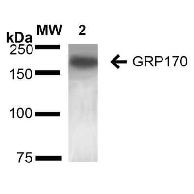 Western Blot: ORP150/HSP12A Antibody (6E3-2C3) [NBP2-59345]