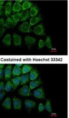 Immunocytochemistry/ Immunofluorescence: ORP150/HSP12A Antibody [NBP1-32140]