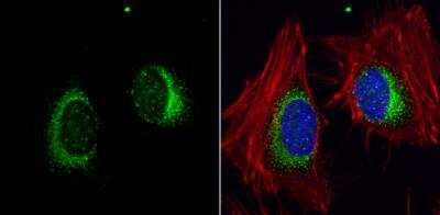 Immunocytochemistry/ Immunofluorescence: ORP150/HSP12A Antibody [NBP1-32140]