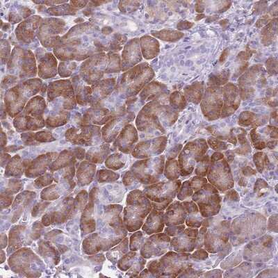 Immunohistochemistry-Paraffin: ORP150/HSP12A Antibody [NBP2-14113]