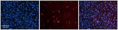 Immunohistochemistry: ORP8 Antibody [NBP1-59814]