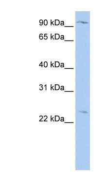 Western Blot: ORP8 Antibody [NBP1-59814]