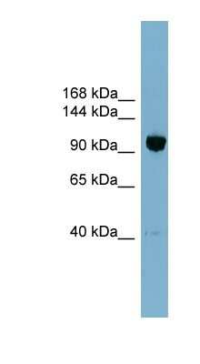 Western Blot: ORP8 Antibody [NBP1-59815]