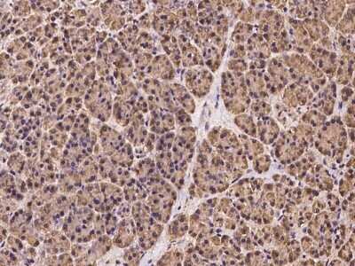 Immunohistochemistry-Paraffin: OS9 Antibody [NBP2-97279]
