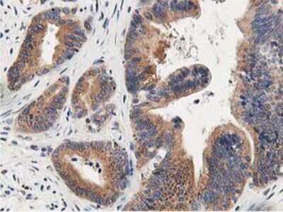 Immunohistochemistry-Paraffin: OSBP1 Antibody (OTI1F2) [NBP2-00935]