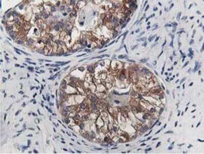 Immunohistochemistry-Paraffin: OSBP1 Antibody (OTI1F2) [NBP2-00935]