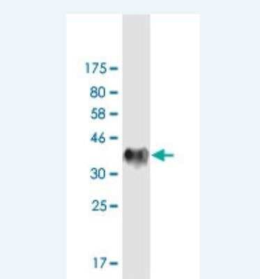 Western Blot: OSBP1 Antibody (5A3) [H00005007-M01-100ug]