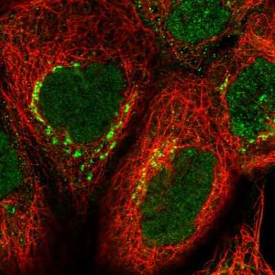 Immunocytochemistry/ Immunofluorescence: OSBP1 Antibody [NBP2-47342]