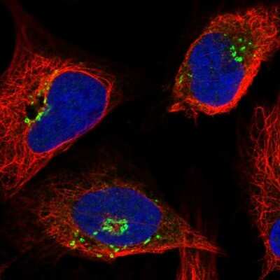 Immunocytochemistry/ Immunofluorescence: OSBP1 Antibody [NBP2-47343]