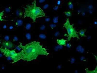 Immunocytochemistry/ Immunofluorescence: OSBP1 Antibody (OTI1F2) - Azide and BSA Free [NBP2-73152]
