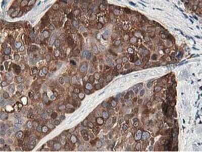 Immunohistochemistry: OSBP1 Antibody (OTI1F2) - Azide and BSA Free [NBP2-73152]