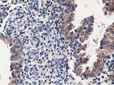 Immunohistochemistry: OSBP1 Antibody (OTI1F2) - Azide and BSA Free [NBP2-73152]
