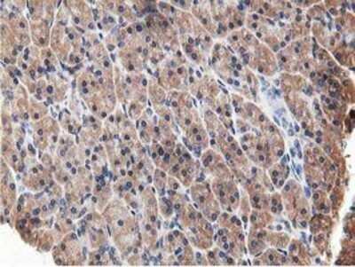 Immunohistochemistry: OSBP1 Antibody (OTI1F2) - Azide and BSA Free [NBP2-73152]