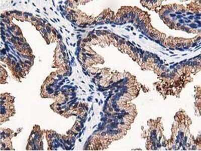 Immunohistochemistry: OSBP1 Antibody (OTI1F2) - Azide and BSA Free [NBP2-73152]