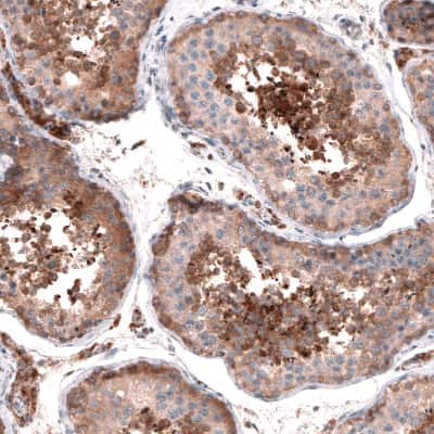 Immunohistochemistry-Paraffin: OSBP2 Antibody [NBP1-81388]
