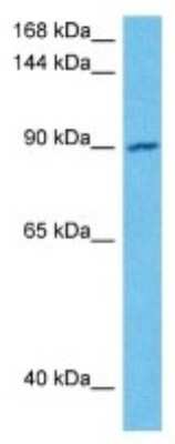 Western Blot: OSBP2 Antibody [NBP3-10047]