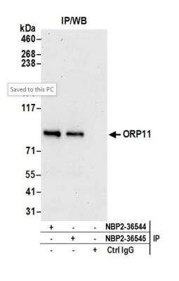 Immunoprecipitation: OSBPL11 Antibody [NBP2-36544]