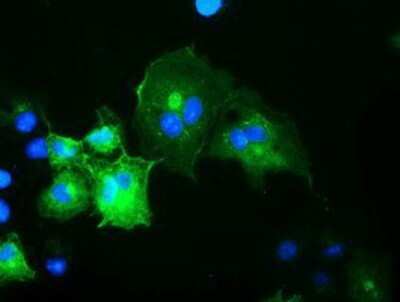 Immunocytochemistry/ Immunofluorescence: OSBPL11 Antibody (OTI6A6) - Azide and BSA Free [NBP2-73160]
