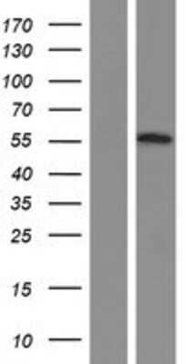 Western Blot: OSBPL2 Overexpression Lysate [NBP2-07264]