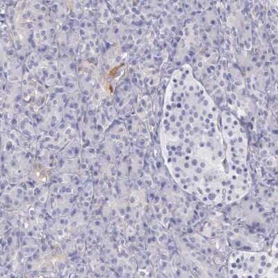 Immunohistochemistry-Paraffin: OSBPL3 Antibody [NBP1-82968]