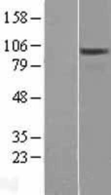 Western Blot: OSBPL3 Overexpression Lysate [NBL1-13988]