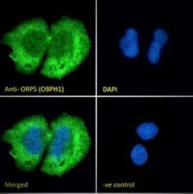 Immunocytochemistry/ Immunofluorescence: OSBPL5 Antibody [NB100-57071]