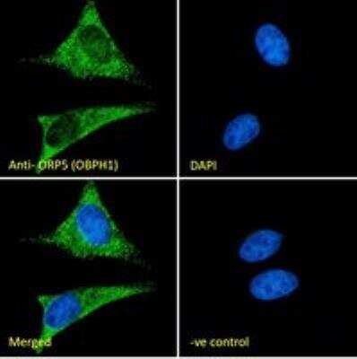Immunocytochemistry/ Immunofluorescence: OSBPL5 Antibody [NB100-57071]
