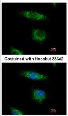 Immunocytochemistry/ Immunofluorescence: OSBPL5 Antibody [NBP2-19638]