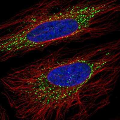 Immunocytochemistry/ Immunofluorescence: OSBPL5 Antibody [NBP2-55591]