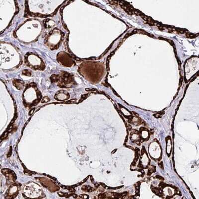 Immunohistochemistry: OSBPL5 Antibody [NBP2-38858]