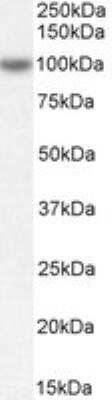 Western Blot: OSBPL5 Antibody [NB100-57071]
