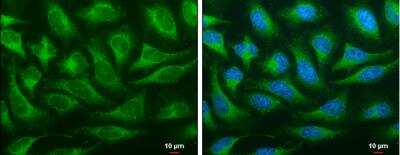 Immunocytochemistry/ Immunofluorescence: OSBPL6 Antibody [NBP1-31456]