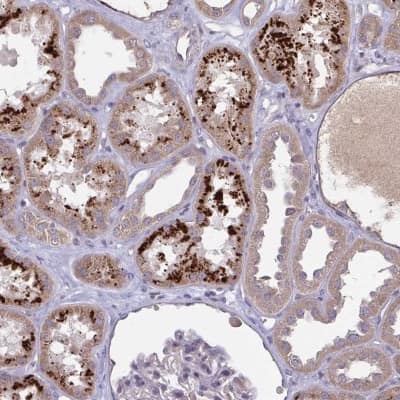 Immunohistochemistry: OSBPL7 Antibody [NBP2-38689]