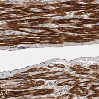 Immunohistochemistry-Paraffin: OSBPL9 Antibody [NBP1-85954]