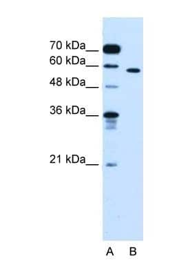 Western Blot: OSBPL9 Antibody [NBP1-55152]