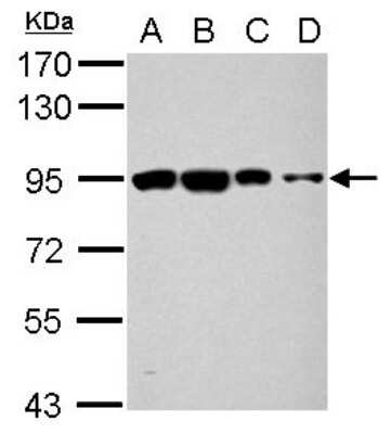 Western Blot: OSBPL9 Antibody [NBP2-19639]
