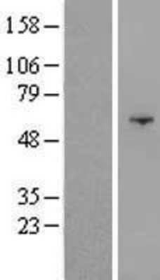 Western Blot: OSBPL9 Overexpression Lysate [NBL1-13996]