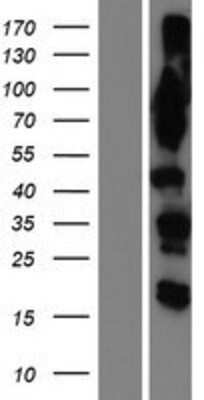 Western Blot: OSBPL9 Overexpression Lysate [NBP2-09996]
