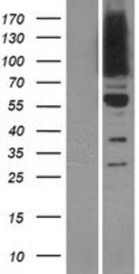 Western Blot: OSBPL9 Overexpression Lysate [NBP2-09997]