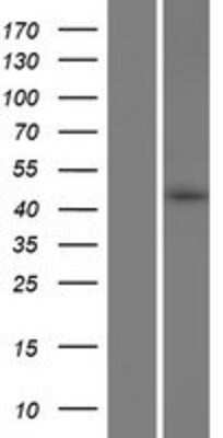 Western Blot: NOR1/OSCP1 Overexpression Lysate [NBP2-05510]